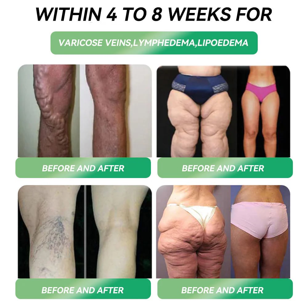 Official Store |Six-in-One Health Solution Oral Liquid (Just once a day, visible changes in 7 days) For obesity, cardiovascular health, diabetes, sleep apnea, Gut Health, joint issues, and more